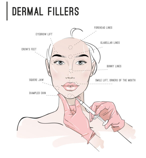 Temporary vs. Permanent Dermal Fillers, Types, Pros and Cons